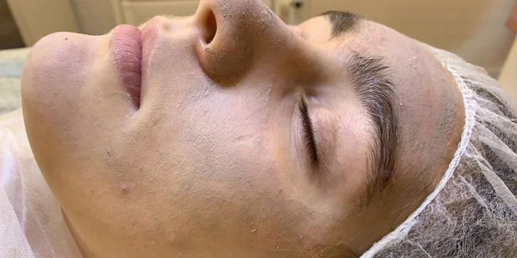 Ultrazvukové čištění pleti, anti-age peeling nebo omlazující kúra dle výběru