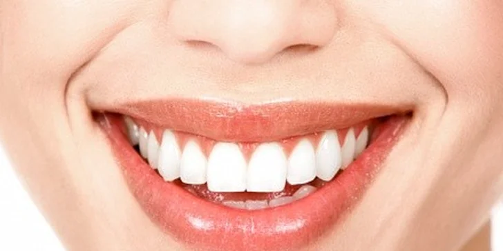 Profesionální dentální hygiena s možností Air Flow