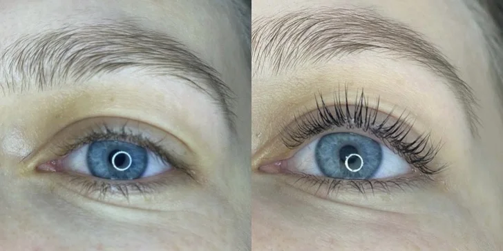 Řasy jako z reklamy: Lash lifting a barvení řas vč. výživy