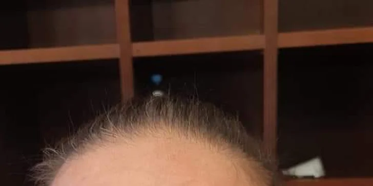 Permanentní make-up: horní a dolní linky, obočí i kontura a výplň rtů