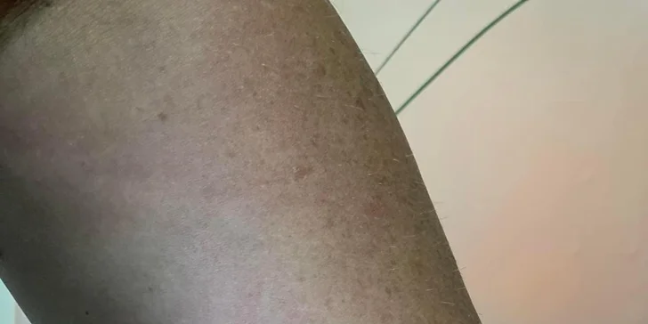 Nové tetování či úprava stávajícího v Táboře: rozměr 5 x 5 nebo 10 x 10 cm