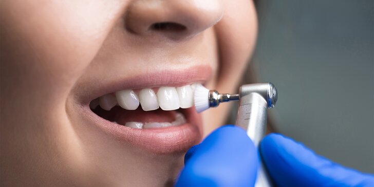 Komplexní dentální hygiena včetně čištění metodou Air Flow