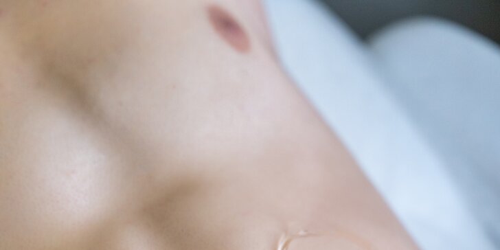 Trvalá laserová epilace pro pány: krk, záda, hrudník, ramena nebo podpaží