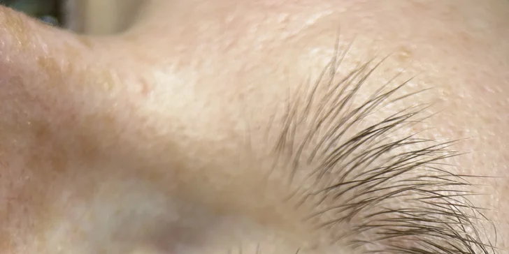 Laminace, lash lifting řas nebo inovativní peeling BioRePeelCL3