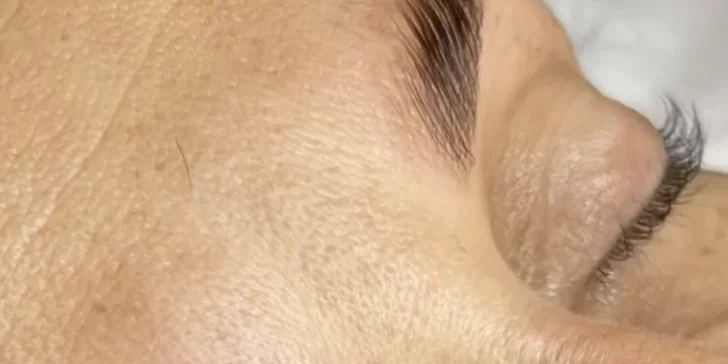 Laminace, lash lifting řas nebo inovativní peeling BioRePeelCL3