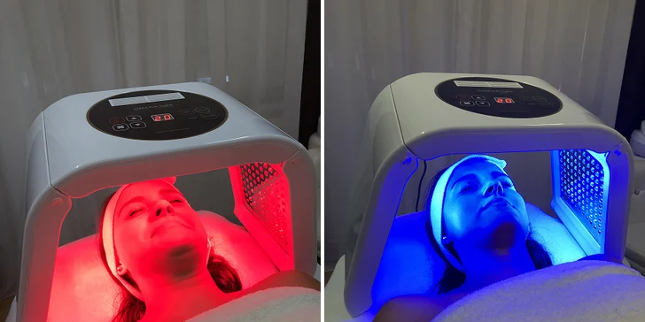 Karbonový peeling, diamantová mikrodermabraze nebo hloubkové čištění