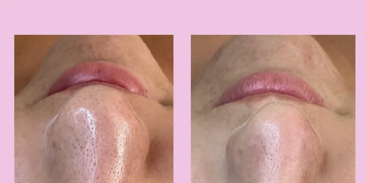 Obnovující, omlazující i komplexní kosmetické ošetření i lash lifting v Liberci