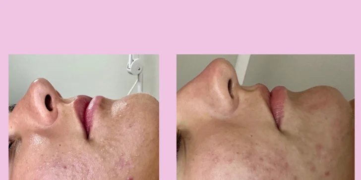 Obnovující, omlazující i komplexní kosmetické ošetření i lash lifting v Liberci