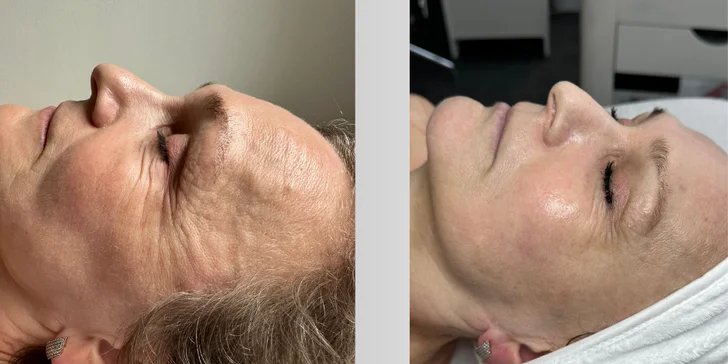 Obnovující, omlazující i komplexní kosmetické ošetření i lash lifting v Liberci