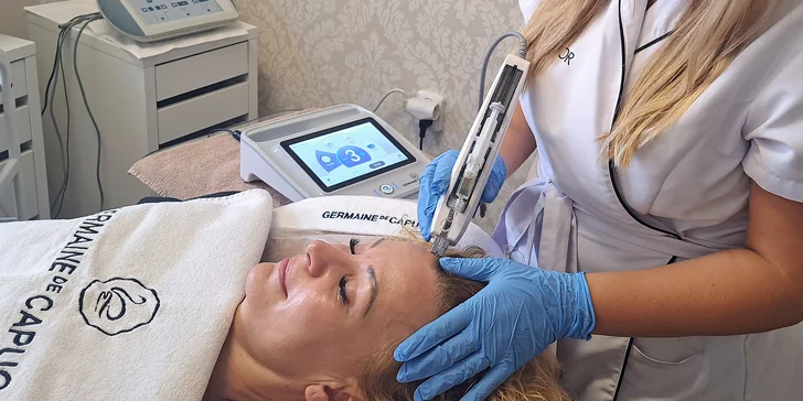 Bezbolestná vlasová mezoterapie Mesoboost pro řídnoucí a slabé vlasy u žen i mužů