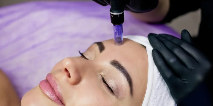 Mikrojehličková mezoterapie i chemický peeling Medik8