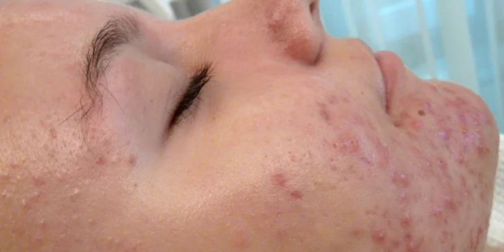 Přístrojové anti-age ošetření, intenzivní výživa, detox procedury pro různé typy pleti