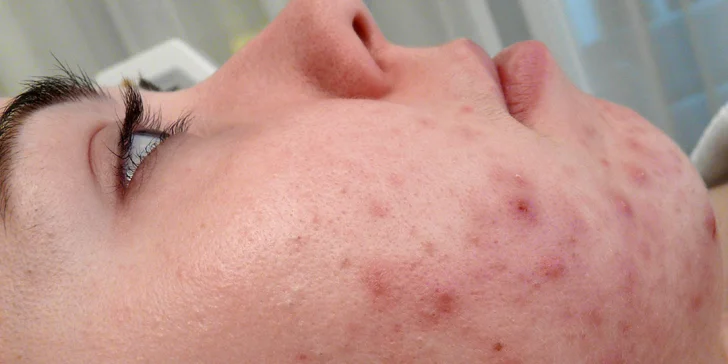 Přístrojové anti-age ošetření, intenzivní výživa, detox procedury pro různé typy pleti