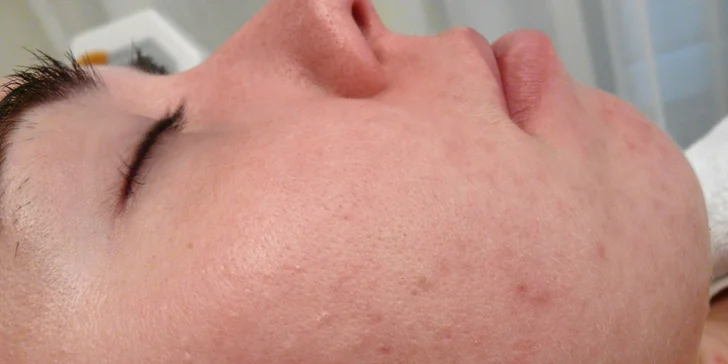 Přístrojové anti-age ošetření, intenzivní výživa, detox procedury pro různé typy pleti
