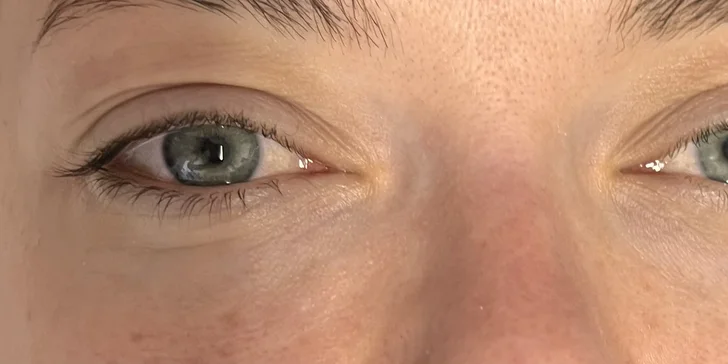 Ohromující pohled: laminace obočí, lash lifting či balíček obou procedur