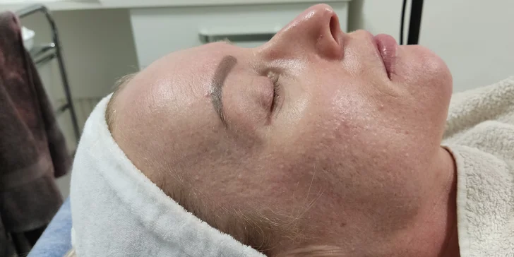 Kosmetické ošetření dle výběru, mikrodermabraze nebo mezoterapie