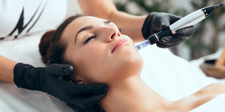 Relaxační a omlazující ošetření obličeje, krku a dekoltu pomocí mikrojehličkové mezoterapie