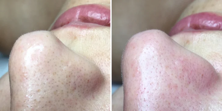 Laminace, lash lifting řas nebo základní ošetření pleti