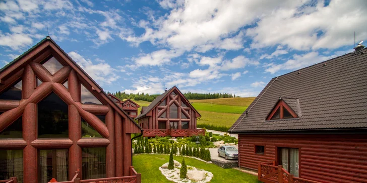 Pobyt s noblesou: luxusní chaty s výhledem na Belianské Tatry, vlastní sauna a jacuzzi na terase