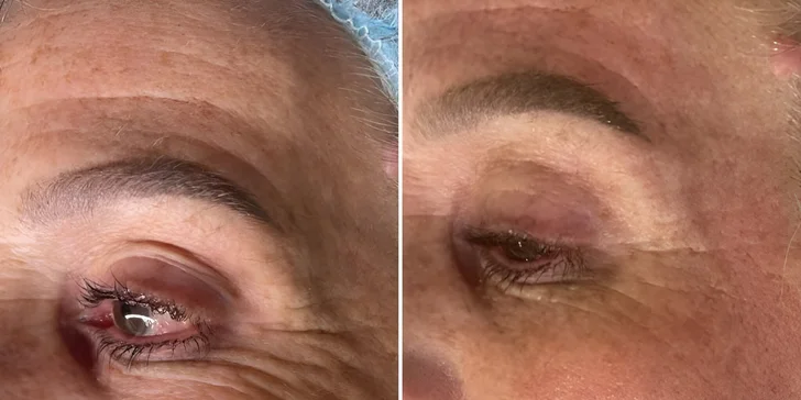 Kosmetické bylinné ošetření pleti Green Peel pro osvěžení i energii