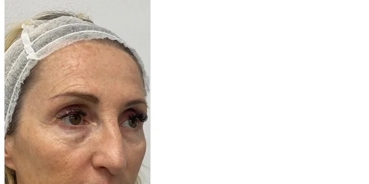 Kosmetické ošetření dle výběru: hloubková hydratace i anti-age s LED terapií