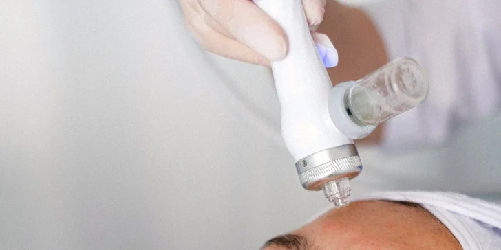Kosmetické ošetření pro krásnější pleť: chemický peeling, hydratační ošetření i mikrojehličkování