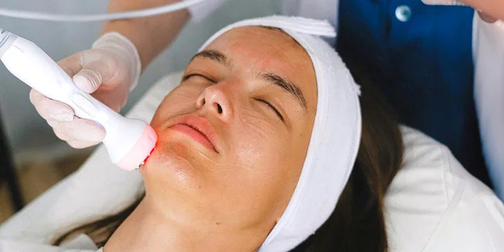 Kosmetické ošetření pro krásnější pleť: chemický peeling, hydratační ošetření i mikrojehličkování