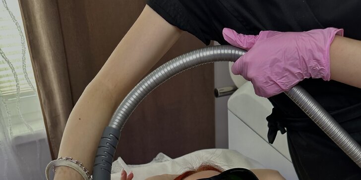 Laserová epilace pro ženy: trvalé odstranění chloupků diodovým laserem
