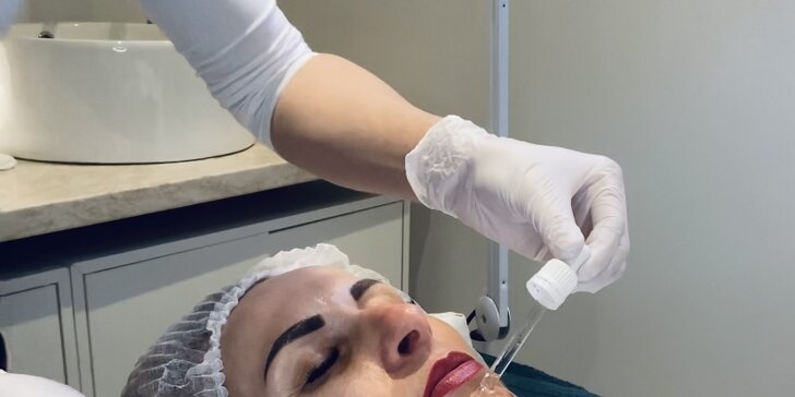 Chemický peeling obličeje, dekoltu nebo jehličková mezoterapie
