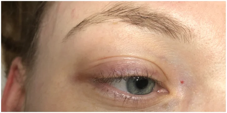 Pro uhrančivý pohled: lash lifting či laminace obočí včetně barvení