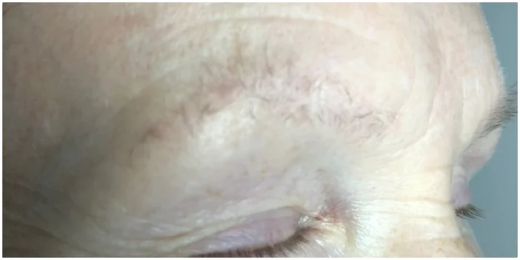 Pro uhrančivý pohled: lash lifting či laminace obočí včetně barvení