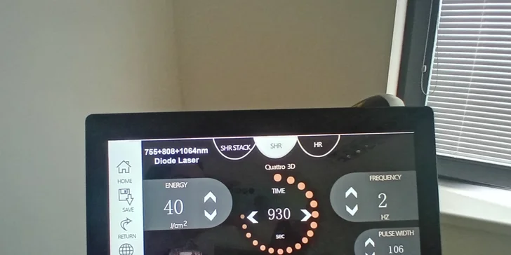 Laserová epilace pro muže: záda i ramena, nohy, ruce, břicho nebo hrudník