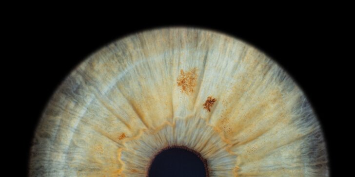 Originální fotografie oční duhovky: jedno i dvě oči či jejich splynutí v jeden obraz