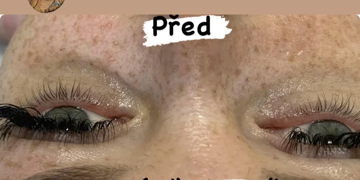 Kosmetické ošetření dle výběru: peeling, hydratace i lifting, proti akné i vráskám