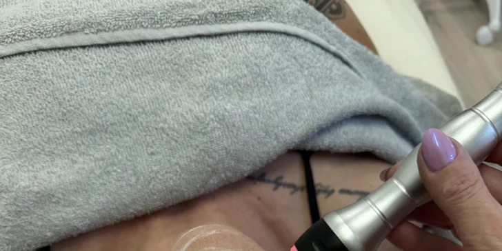 Kosmetické balíčky: základní péče, mezoterapie, lifting či ošetření aknózní pleti
