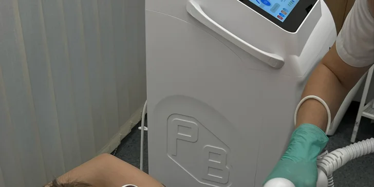 Laserová epilace: diodovým laserem Ultimate: celý obličej, ruce i nohy