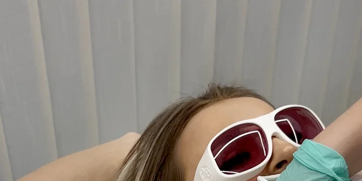Laserová epilace: diodovým laserem Ultimate: celý obličej, ruce i nohy