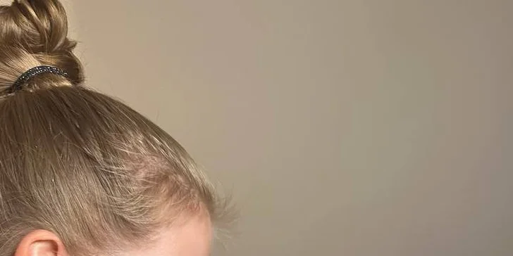 Omlazení pleti: lifting, ultrazvukové či manuální čištění, karboxyterapie, TC Plus peeling nebo mezoterapie