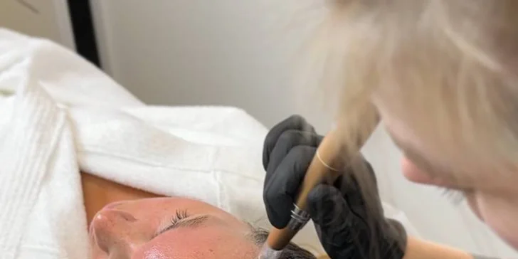 Omlazení pleti: lifting, ultrazvukové či manuální čištění, karboxyterapie, TC Plus peeling nebo mezoterapie