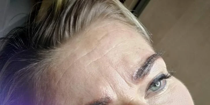 Kosmetické ošetření s ultrazvukovou špachtlí, chemický peeling či omlazující mezoterapie