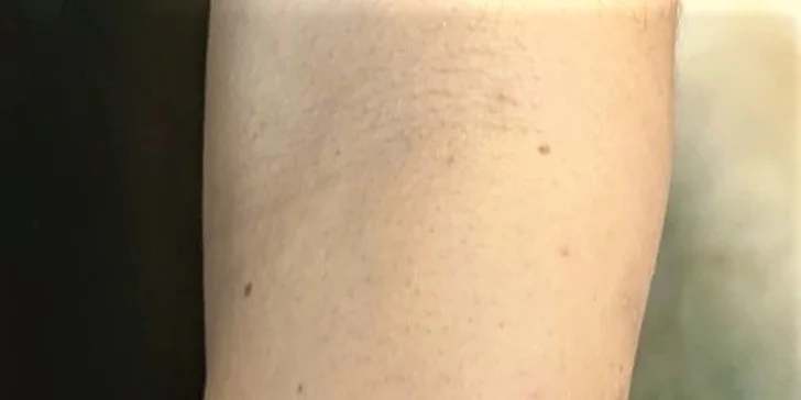 Zbrusu nové tetování s vaším vysněným motivem o velikosti 10 x 10 cm
