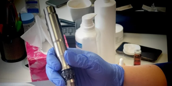 Kosmetické ošetření s ultrazvukovou špachtlí, chemický peeling či omlazující mezoterapie