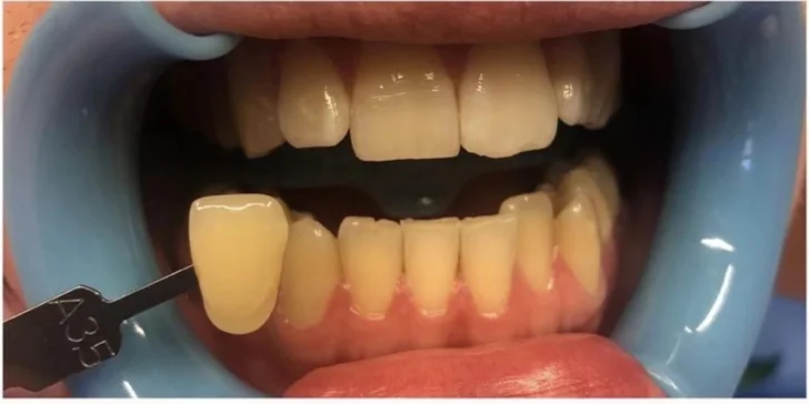 Dentální hygiena a bělení zubů v moderní ordinaci: děti a mládež do 15 let i dospělí