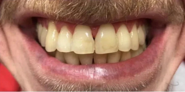Dentální hygiena a bělení zubů v moderní ordinaci: děti a mládež do 15 let i dospělí