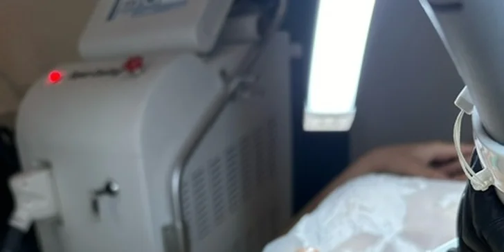 Laserová epilace vybraných partií v Lann Spa