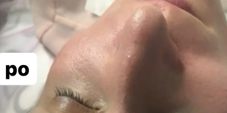 Kosmetická péče: hloubkové čištění pleti či peeling pro hladkou a mladistvou pleť