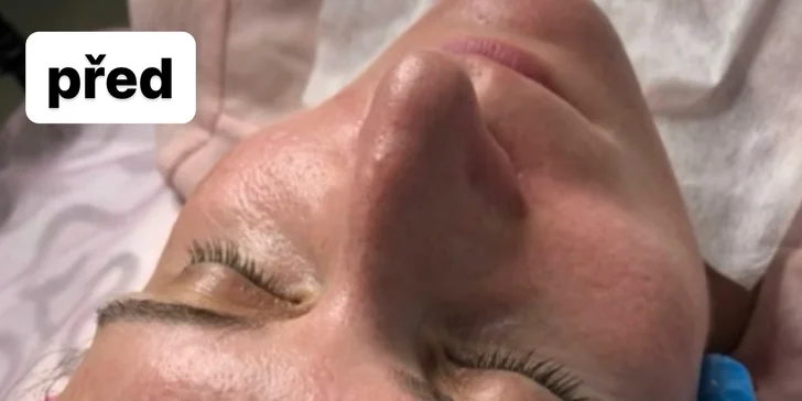 Kosmetická péče: hloubkové čištění pleti či peeling pro hladkou a mladistvou pleť