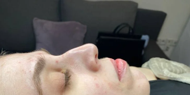 Omlazení pleti: lifting, ultrazvukové či manuální čištění, karboxyterapie, TC Plus peeling nebo mezoterapie