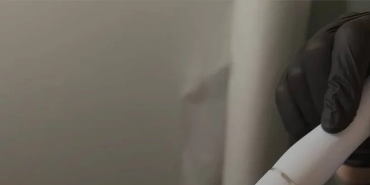 Omlazení pleti: lifting, ultrazvukové či manuální čištění, karboxyterapie, TC Plus peeling nebo mezoterapie