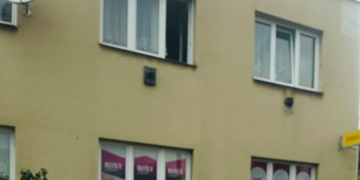 Chemický peeling, diamantová mikrodermabraze i hloubkové čištění